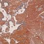 Marble slabs 'Rouge Royal Clair' - Only available in our physical shop